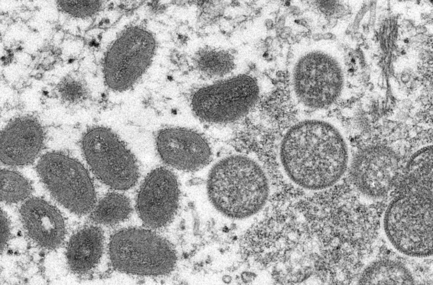  Casos de varíola dos macacos aumentam no mundo; governo brasileiro cria comissão para acompanhar situação no país